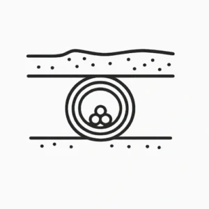 underground conduit systems